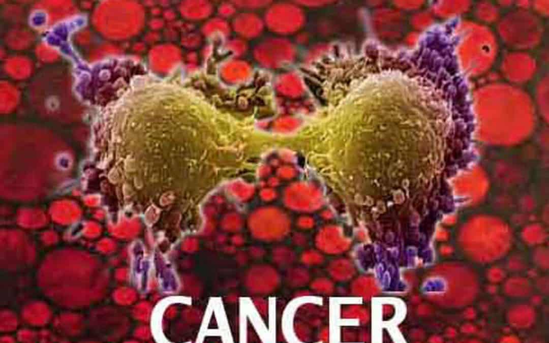 Cancer to be A Major Disease in India: Change in Lifestyle Main Culprit
