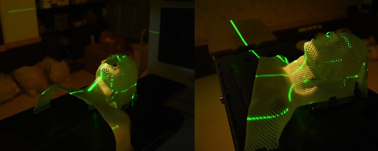 External Radiation External Radiation