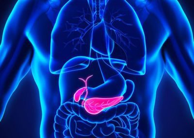 Pancreatic cancer the dangerous killer