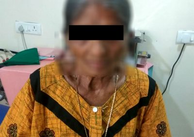 Treatment for elderly at MIO