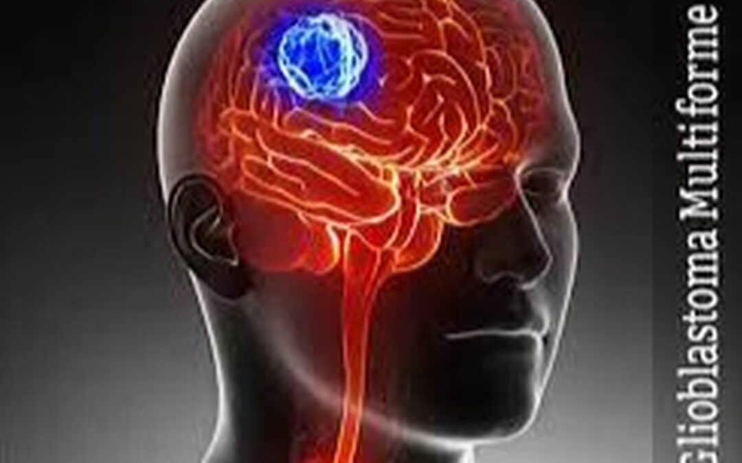 Glioblastoma (GBM) Awareness Day
